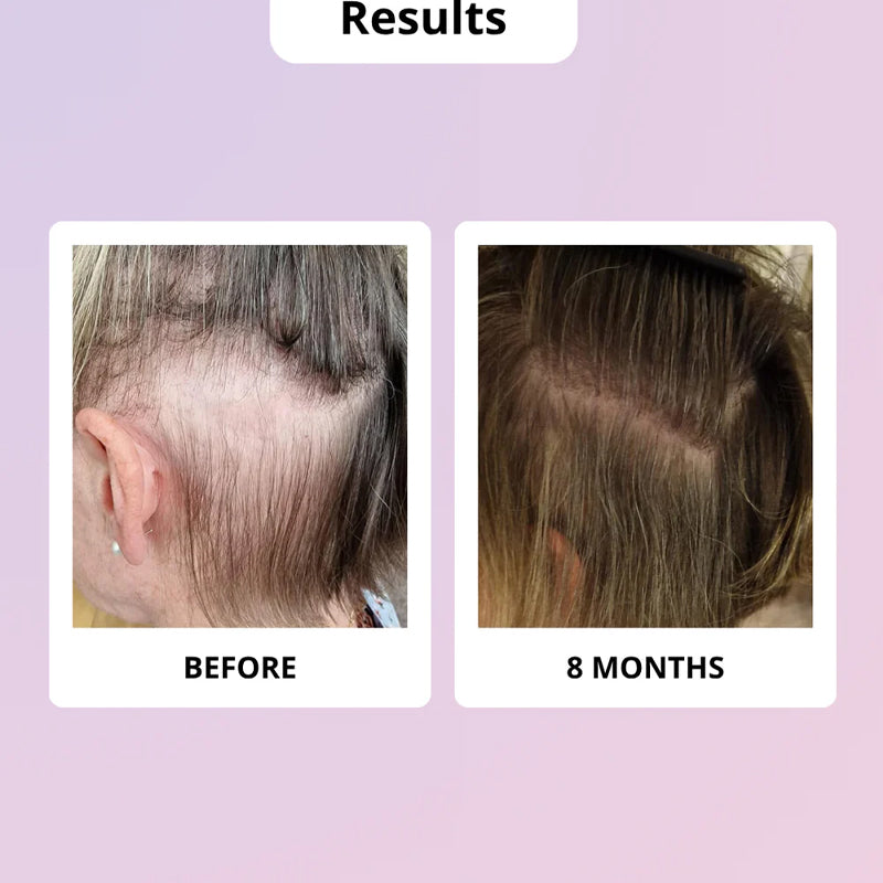 GLOWWA Hair Food Meno Integratore Per Capelli 60 Capsule