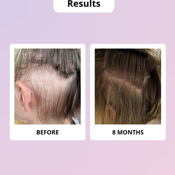 GLOWWA Hair Food Meno Integratore Per Capelli 60 Capsule