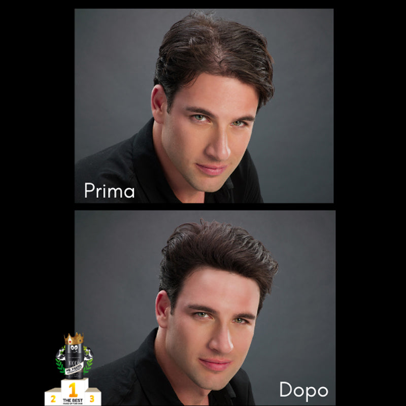 TOPPIK Fibre Capillari Densificanti Di Cheratina Naturale DARK BROWN 27.5g