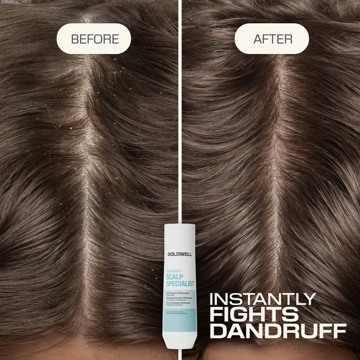 GOLDWELL DS Scalp Specialist Anti-Dandruff Shampoo 250ml (immagine 3)