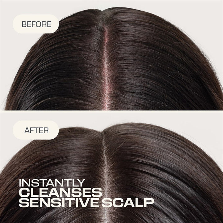GOLDWELL Scalp Specialist Sensitive Foam Shampoo 250ml (immagine 3)